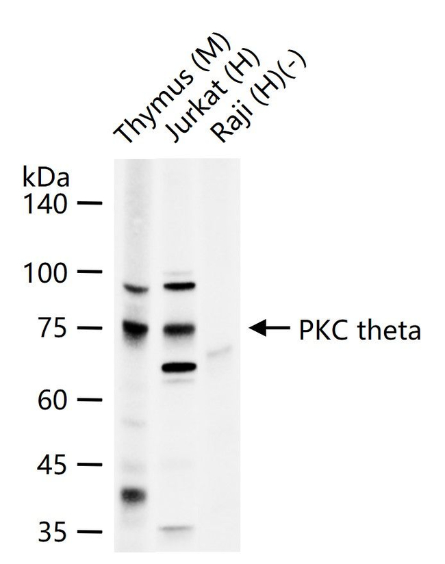 PKC theta Antibody in Western Blot (WB)