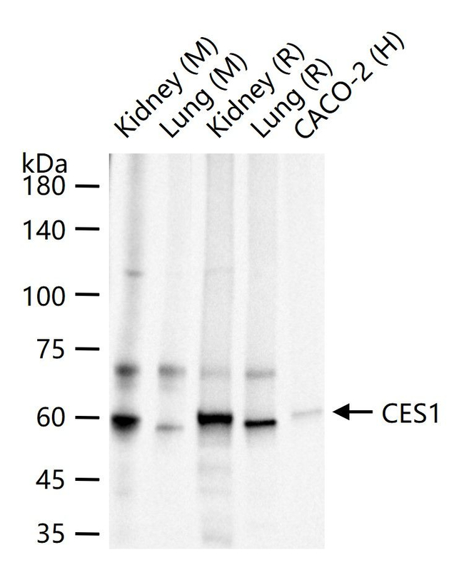 CES1 Antibody in Western Blot (WB)