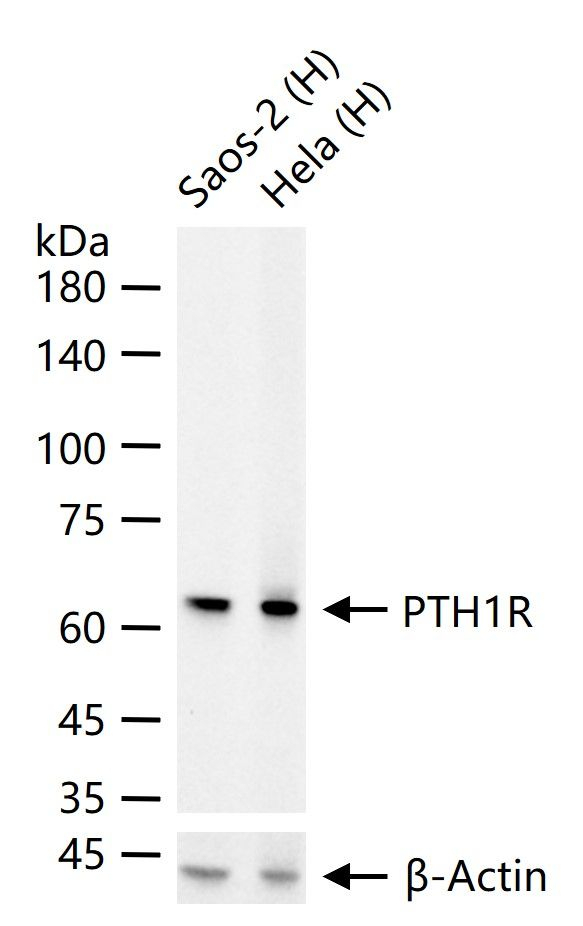 PTH1R Antibody in Western Blot (WB)