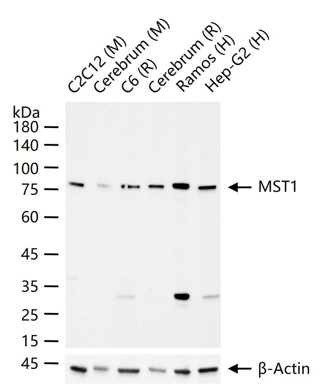 MSP Antibody in Western Blot (WB)