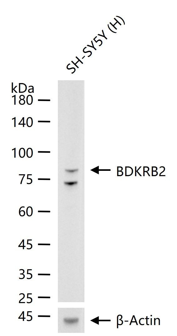 BDKRB2 Antibody in Western Blot (WB)