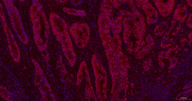 Cullin 4A Antibody in Immunohistochemistry (Paraffin) (IHC (P))