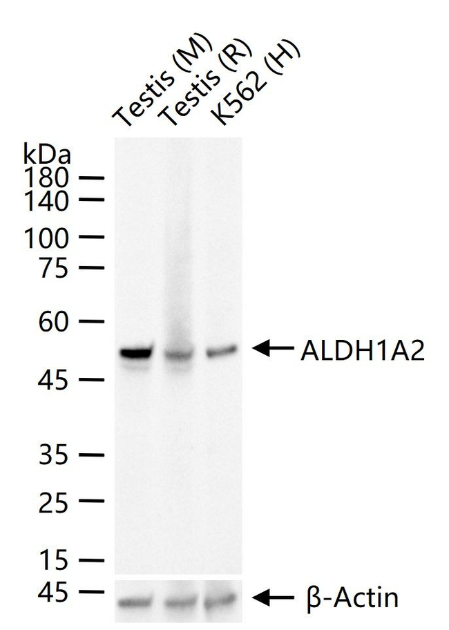 ALDH1A2 Antibody in Western Blot (WB)