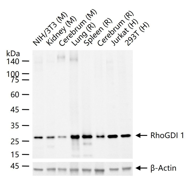 RhoGDI Antibody in Western Blot (WB)