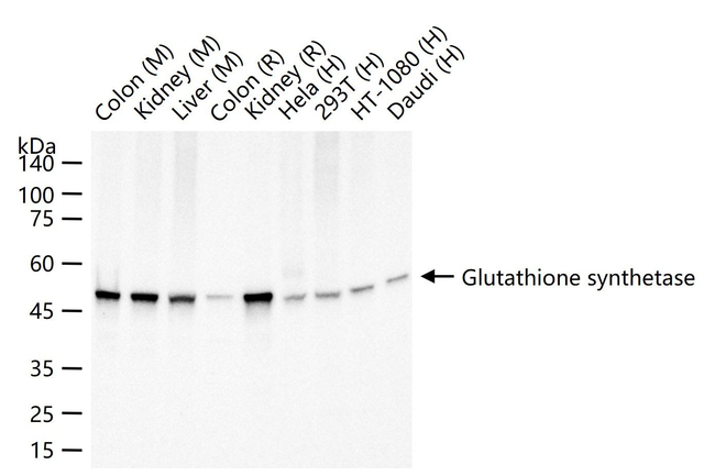 GSS Antibody in Western Blot (WB)