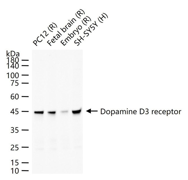 DRD3 Antibody in Western Blot (WB)