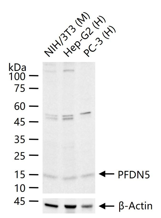 PFDN5 Antibody in Western Blot (WB)