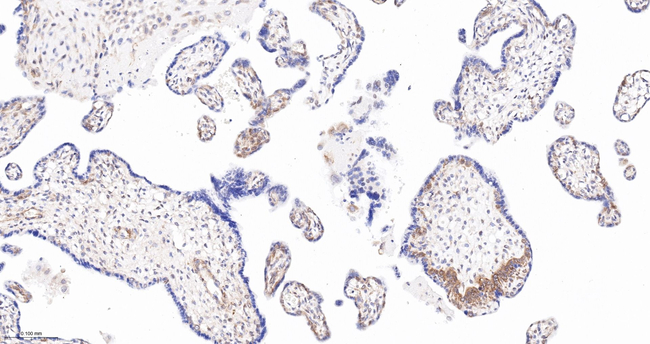 CAS Antibody in Immunohistochemistry (Paraffin) (IHC (P))