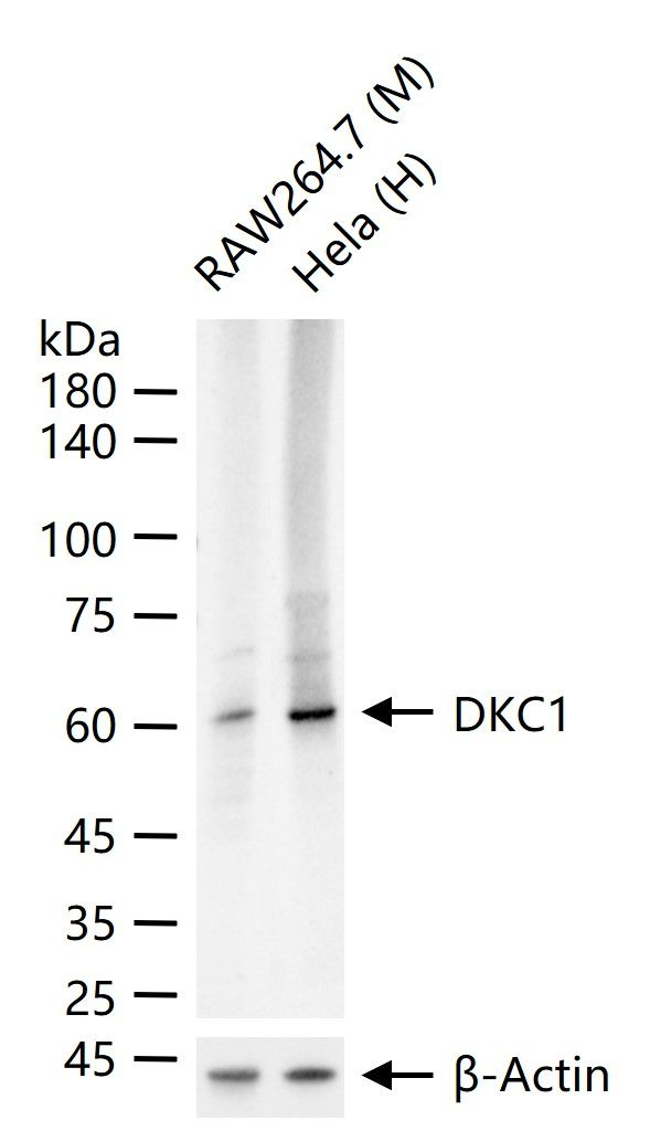 DKC1 Antibody in Western Blot (WB)