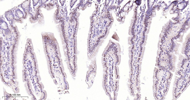 SF3B1 Antibody in Immunohistochemistry (Paraffin) (IHC (P))