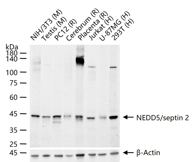 Septin 2 Antibody in Western Blot (WB)