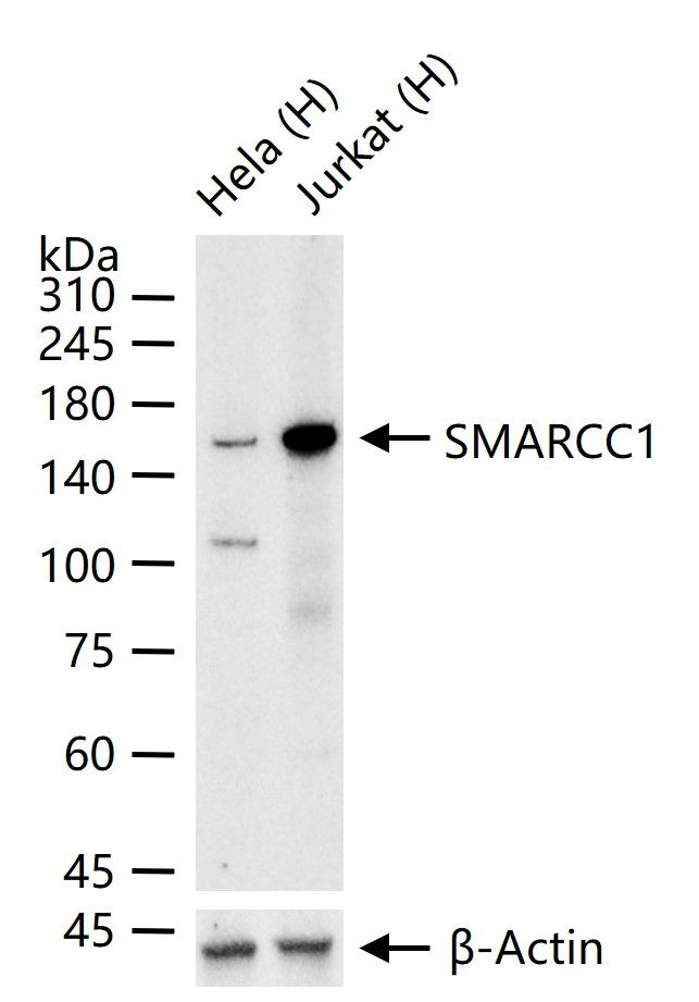 SMARCC1 Antibody in Western Blot (WB)