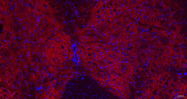 GAT-1 Antibody in Immunohistochemistry (Paraffin) (IHC (P))