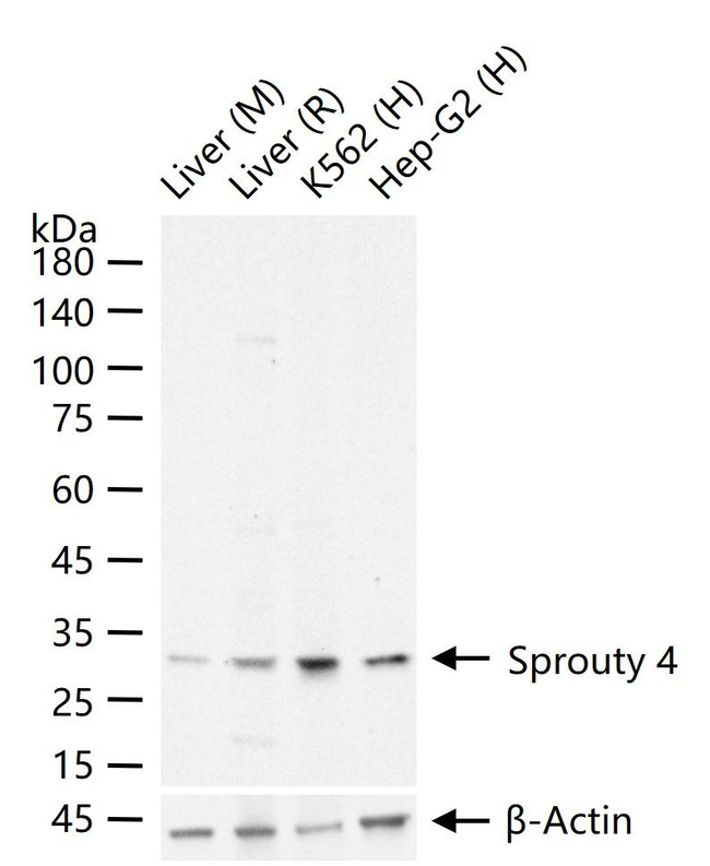 SPRY4 Antibody in Western Blot (WB)