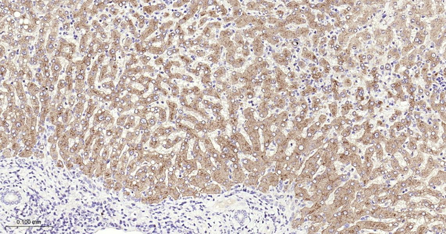TFR2 Antibody in Immunohistochemistry (Paraffin) (IHC (P))