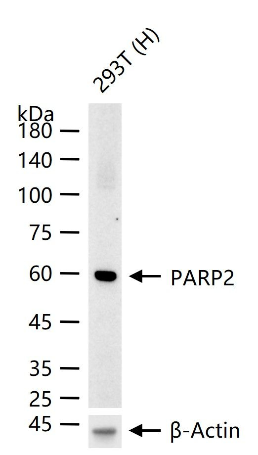 PARP2 Antibody in Western Blot (WB)