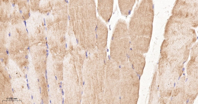 IRS2 Antibody in Immunohistochemistry (Paraffin) (IHC (P))