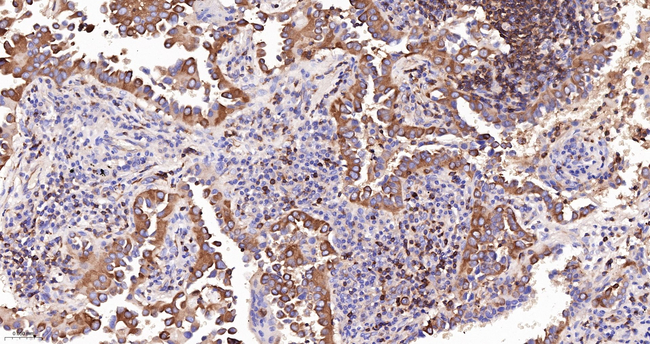 DIAPH1 Antibody in Immunohistochemistry (Paraffin) (IHC (P))