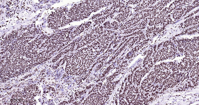 ILF3 Antibody in Immunohistochemistry (Paraffin) (IHC (P))