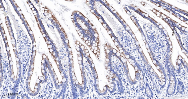 CYP27A1 Antibody in Immunohistochemistry (Paraffin) (IHC (P))