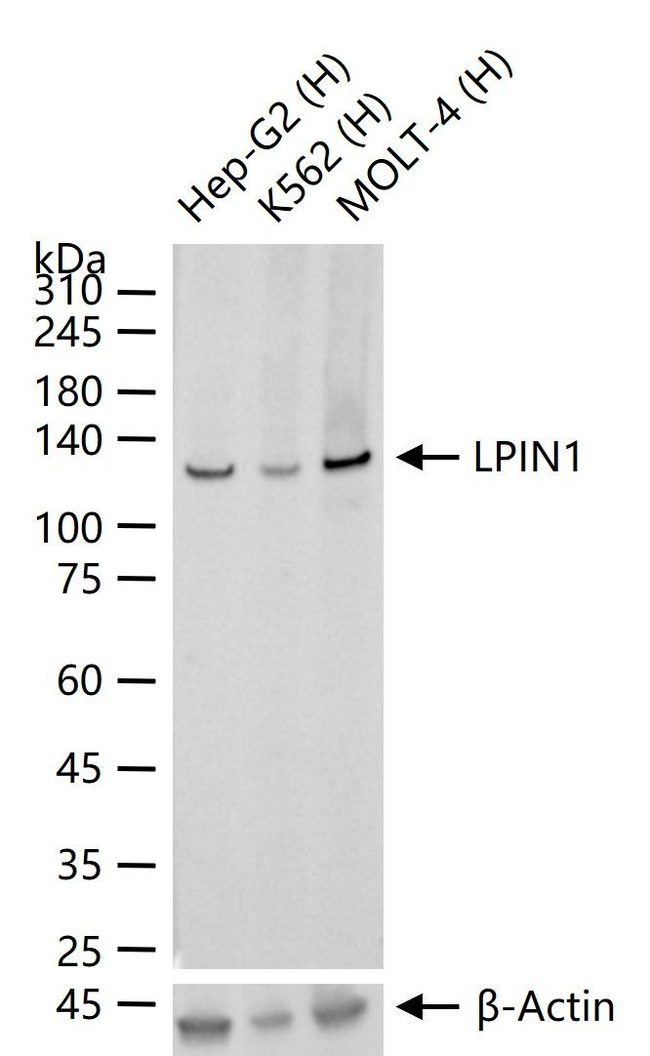 LPIN1 Antibody in Western Blot (WB)