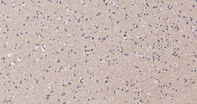 PIST Antibody in Immunohistochemistry (Paraffin) (IHC (P))