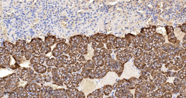 Tetranectin Antibody in Immunohistochemistry (Paraffin) (IHC (P))