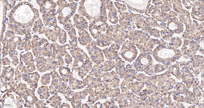 NDUFA13 Antibody in Immunohistochemistry (Paraffin) (IHC (P))