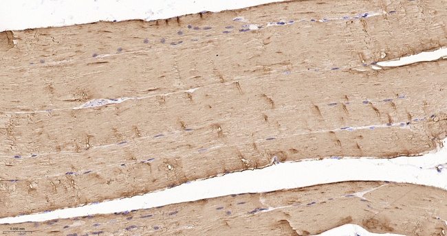 TPM1 Antibody in Immunohistochemistry (Paraffin) (IHC (P))