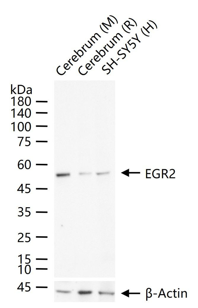 EGR2 Antibody in Western Blot (WB)