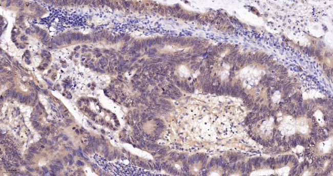 SMN1 Antibody in Immunohistochemistry (Paraffin) (IHC (P))
