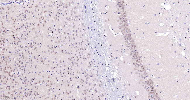 TNPO3 Antibody in Immunohistochemistry (Paraffin) (IHC (P))