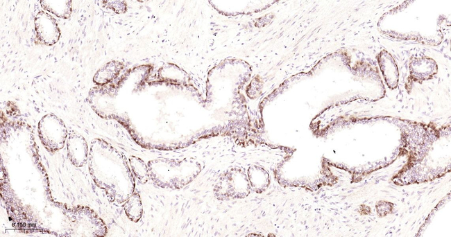 COMT Antibody in Immunohistochemistry (Paraffin) (IHC (P))
