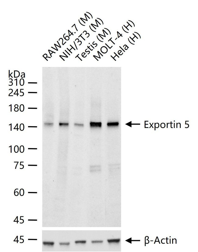 XPO5 Antibody in Western Blot (WB)