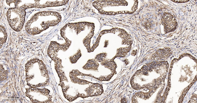 FIS1 Antibody in Immunohistochemistry (Paraffin) (IHC (P))
