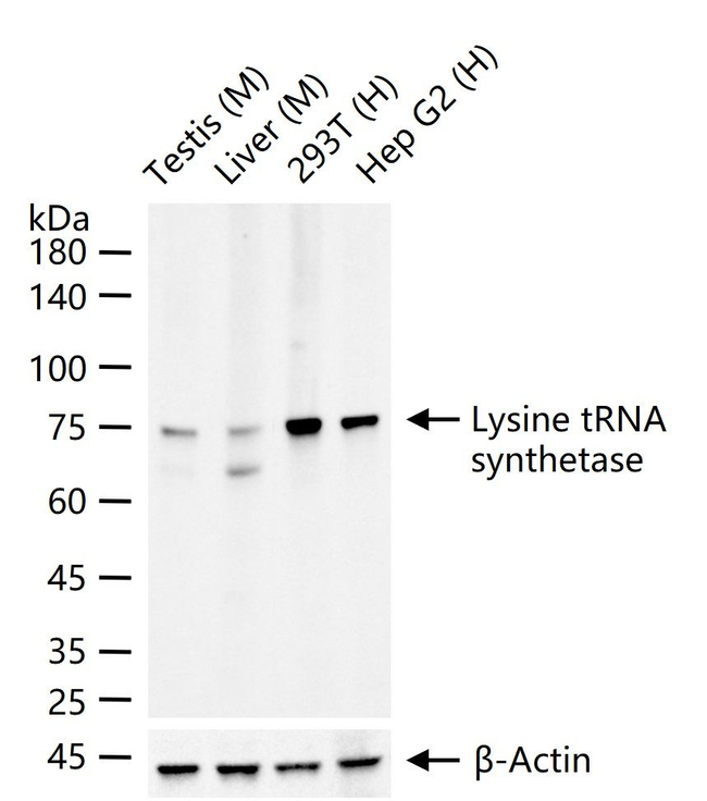 KARS Antibody in Western Blot (WB)