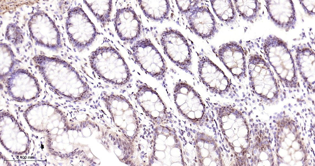 CtBP1 Antibody in Immunohistochemistry (Paraffin) (IHC (P))