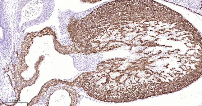 Cardiac Troponin C Antibody in Immunohistochemistry (Paraffin) (IHC (P))