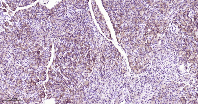 CBS Antibody in Immunohistochemistry (Paraffin) (IHC (P))