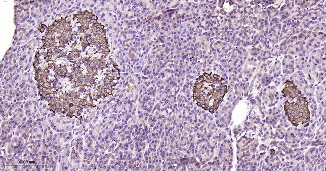 GUCY1B3 Antibody in Immunohistochemistry (Paraffin) (IHC (P))