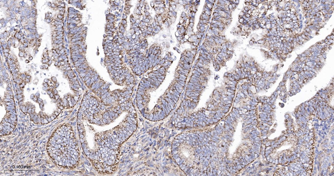 SFRP4 Antibody in Immunohistochemistry (Paraffin) (IHC (P))