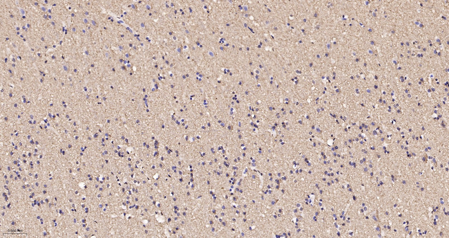 VAMP1 Antibody in Immunohistochemistry (Paraffin) (IHC (P))