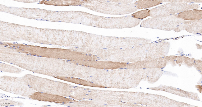 NDUFB8 Antibody in Immunohistochemistry (Paraffin) (IHC (P))