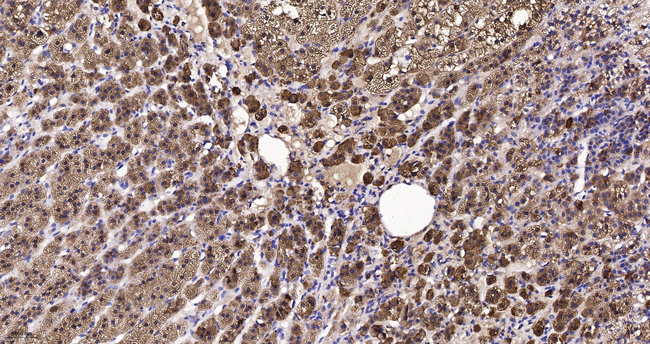 SULT2A1 Antibody in Immunohistochemistry (Paraffin) (IHC (P))