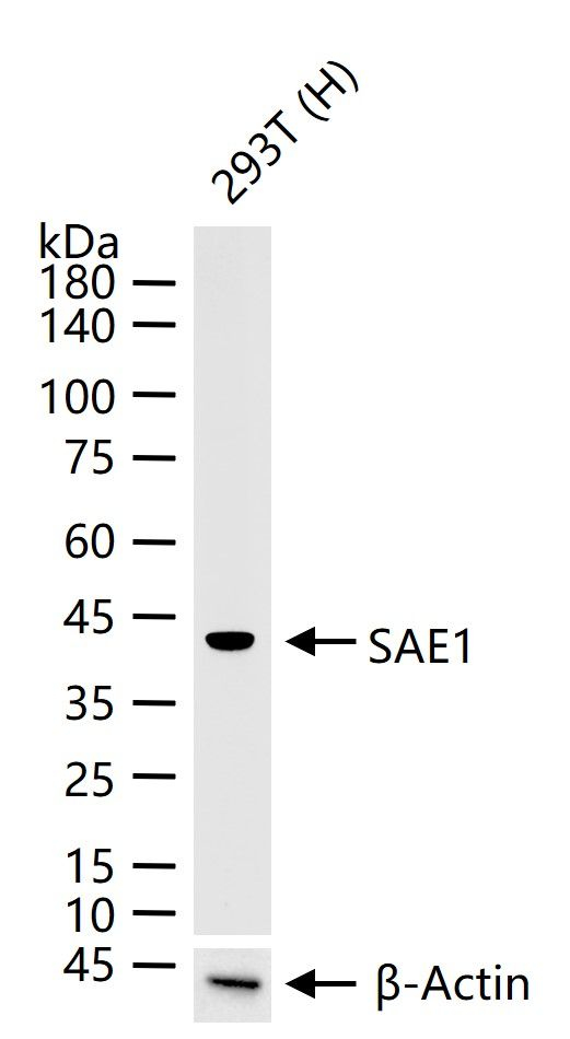 SAE1 Antibody in Western Blot (WB)