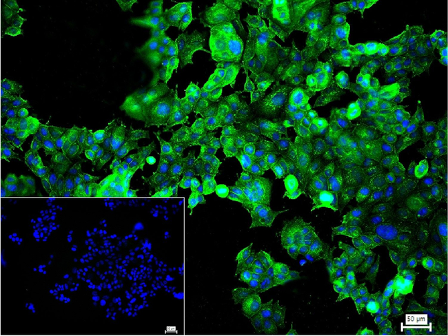 Destrin Antibody in Immunocytochemistry (ICC/IF)