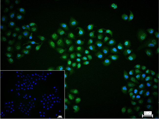 TBLR1 Antibody in Immunocytochemistry (ICC/IF)