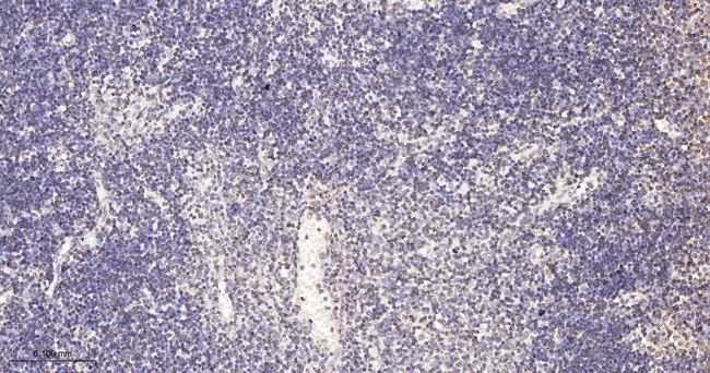 CBF beta Antibody in Immunohistochemistry (Paraffin) (IHC (P))