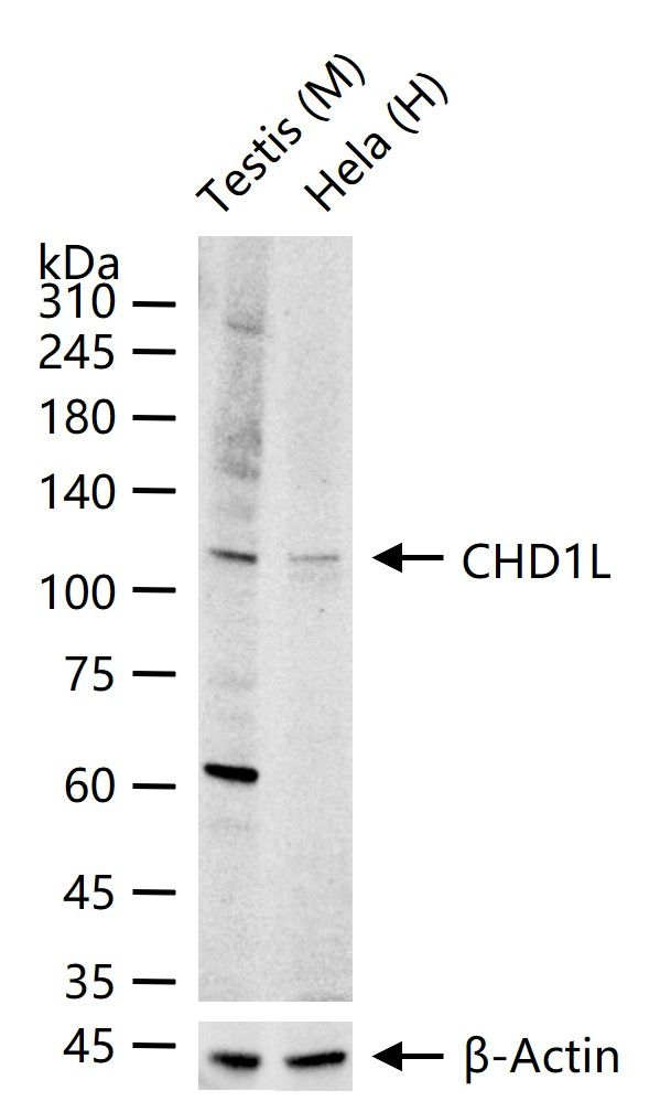 CHD1L Antibody in Western Blot (WB)