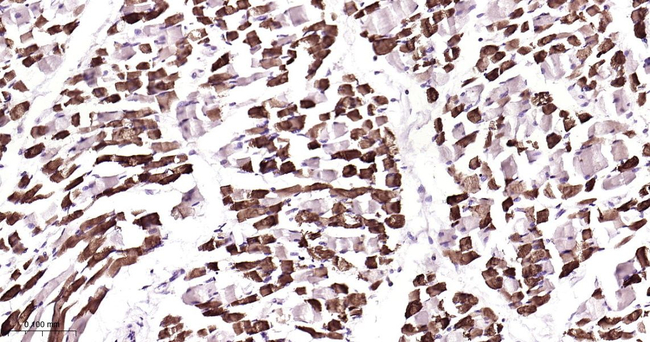 PEN2 Antibody in Immunohistochemistry (Paraffin) (IHC (P))